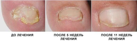 onihomikoz_do_posle_2.jpg
